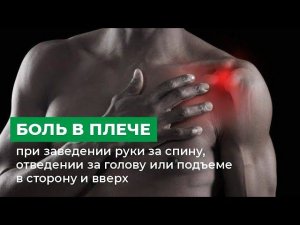 Боль в плече при заведении руки за спину, отведении за голову или подъеме в сторону и вверх