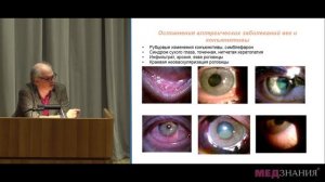 2. «Аллергические заболевания переднего отрезка глаза» Н. Р. Марченко