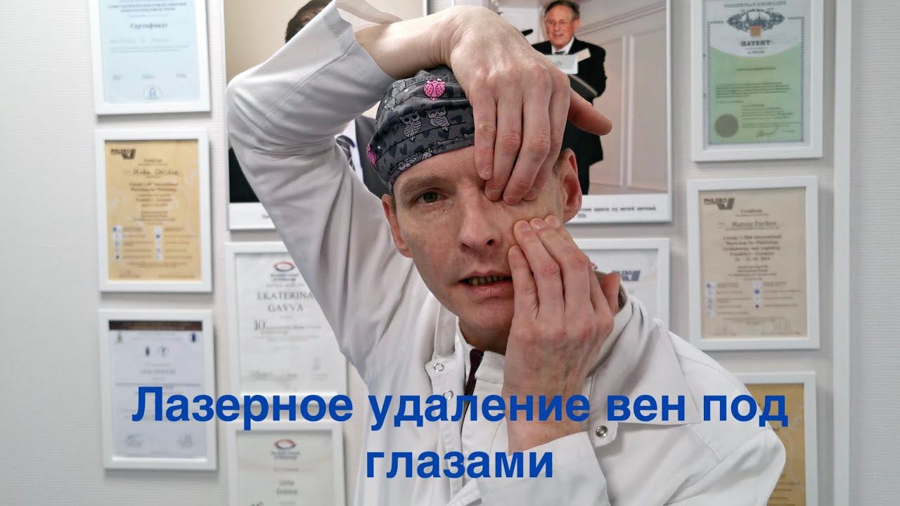 Вены под глазами / 2 часть / Разговор с флебологом / Удаление лазером