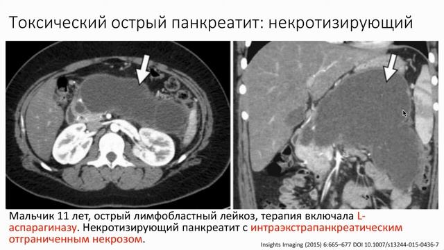 Осложнения у онкологических пациентов. Практическая школа рентгенолога - Цориев Андрей Эльдарович
