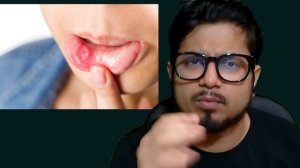 Mouth cancer symptoms in Hindi | early signs of oral cancer