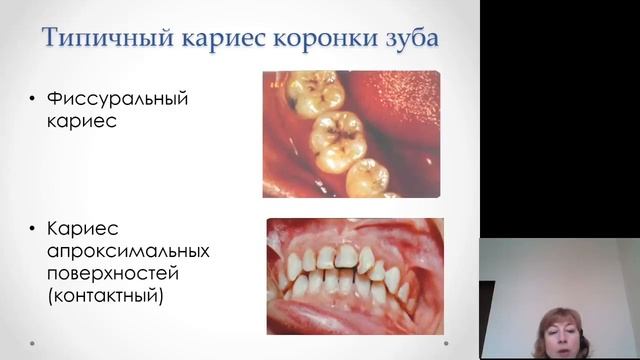 Патанатомия. Структурные основы орофациальной патологии