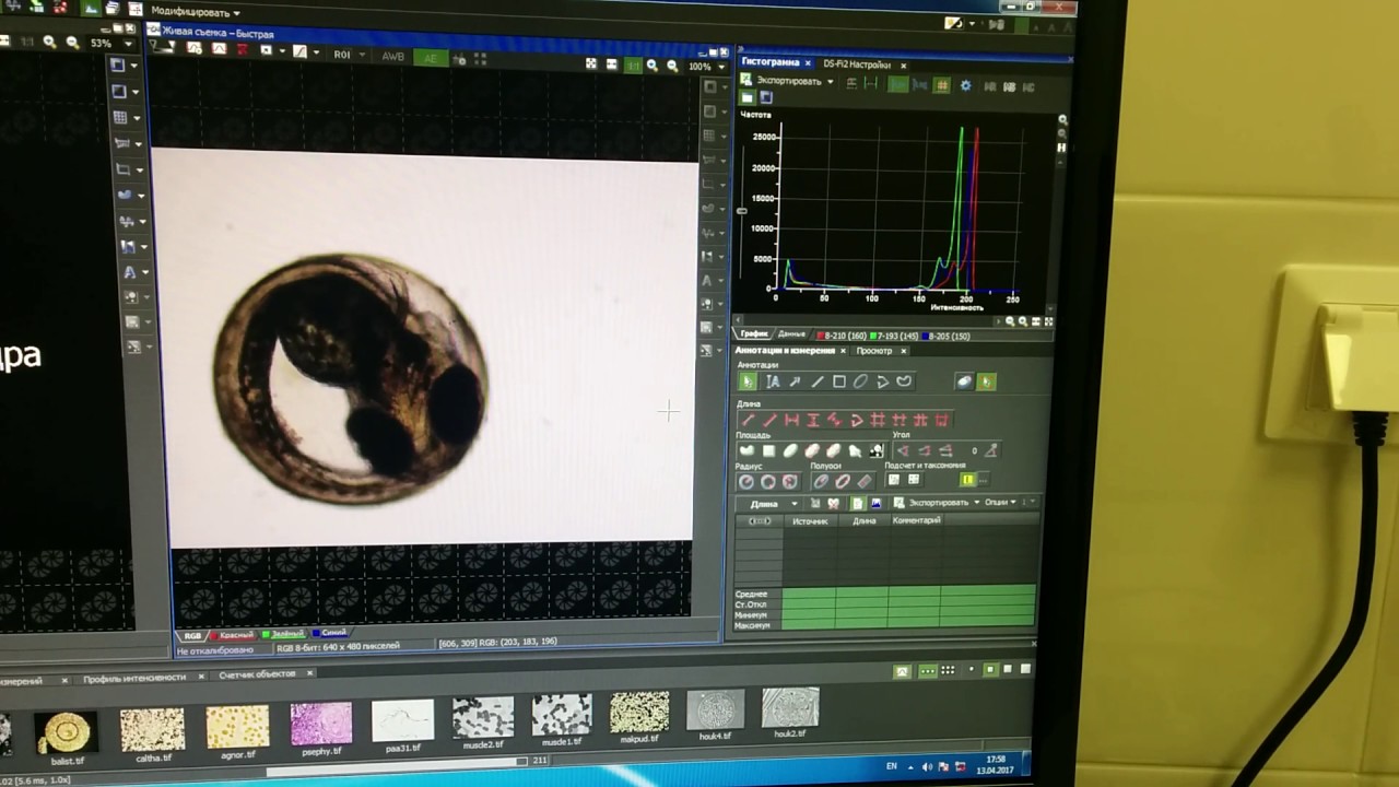 В ЦДТИ проведена дехорионизация личинок zebrafish смотреть онлайн