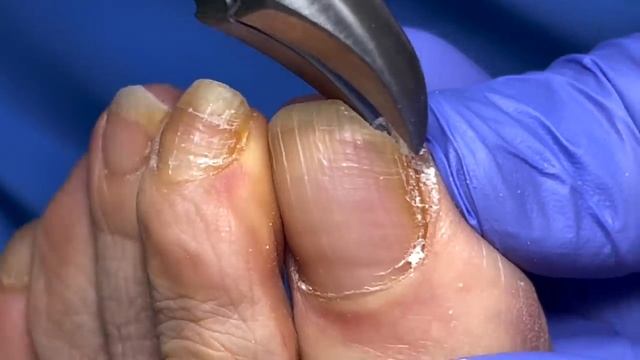 A PARROT TOENAIL? ?