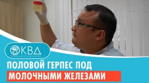 ? Половой герпес под молочными железами. Клинический случай №189