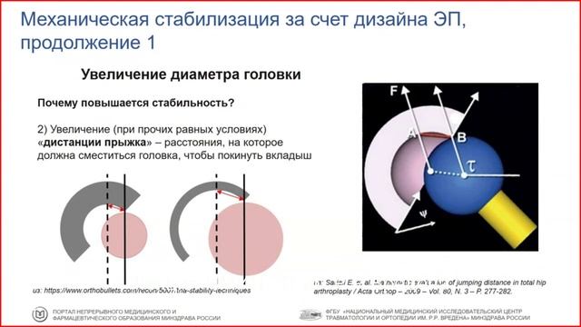 Вывихи после эндопротезирования тазобедренного сустава. Причины и факторы риска.