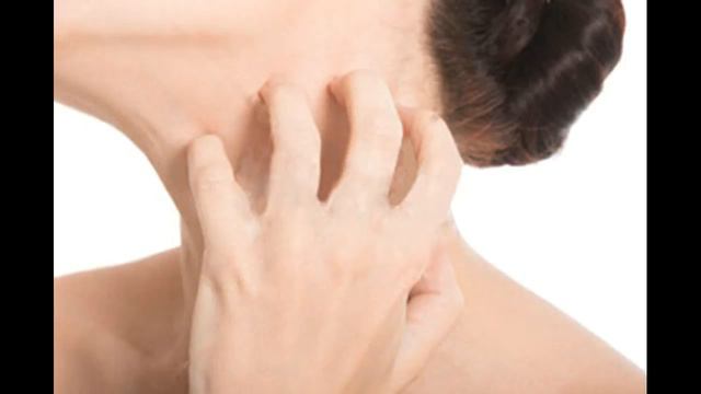 Как лечить и вылечить псориаз