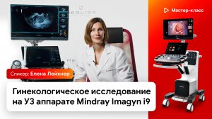 Гинекологическое исследование на УЗИ аппарате Mindray Imagyn i9