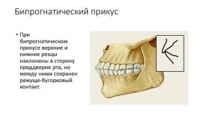 Прикус и разновидности прикуса