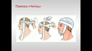 ОБЖ. Азы десмургии. Повязка на голову "Чепец"
