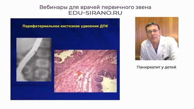 07.04.2021 Панкреатит у детей смотреть онлайн