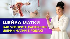 ШЕЙКА МАТКИ. КАК УСКОРИТЬ РАСКРЫТИЕ ШЕЙКИ МАТКИ В РОДАХ?