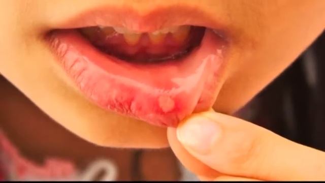 Как избавиться от молочницы смотреть онлайн