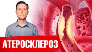 Топ-8 натуральных средств от кальцификации сосудов