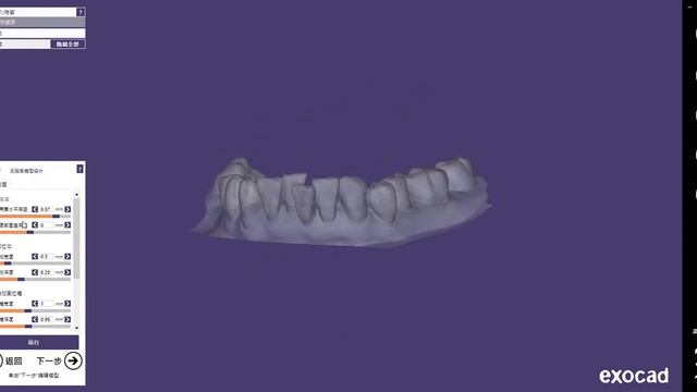 ortho model building with exocad смотреть онлайн