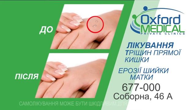 Оксфорд Медікал смотреть онлайн