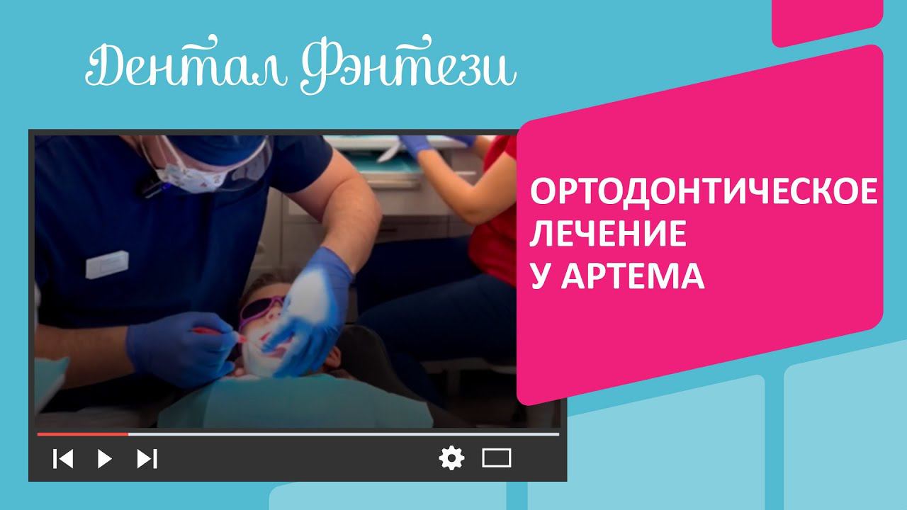 Ортодонтическое лечение у Артема