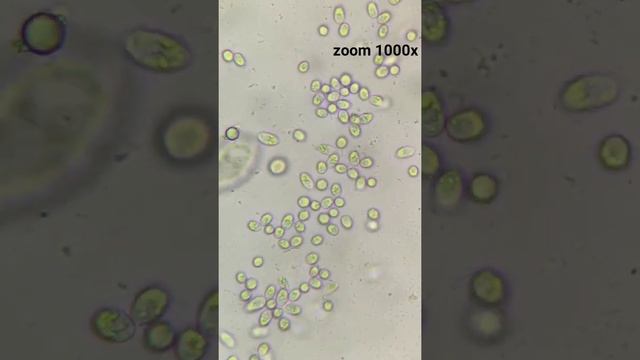 ПОЧЕМУ МУТНЕЕТ ВОДА? смотреть онлайн