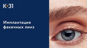 Имплантация факичных линз - современная методика улучшения зрения. Факичные линзы. 18+