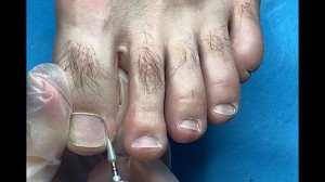 Мужской Аппаратный ПЕДИКЮР Безопасная фреза в педикюре