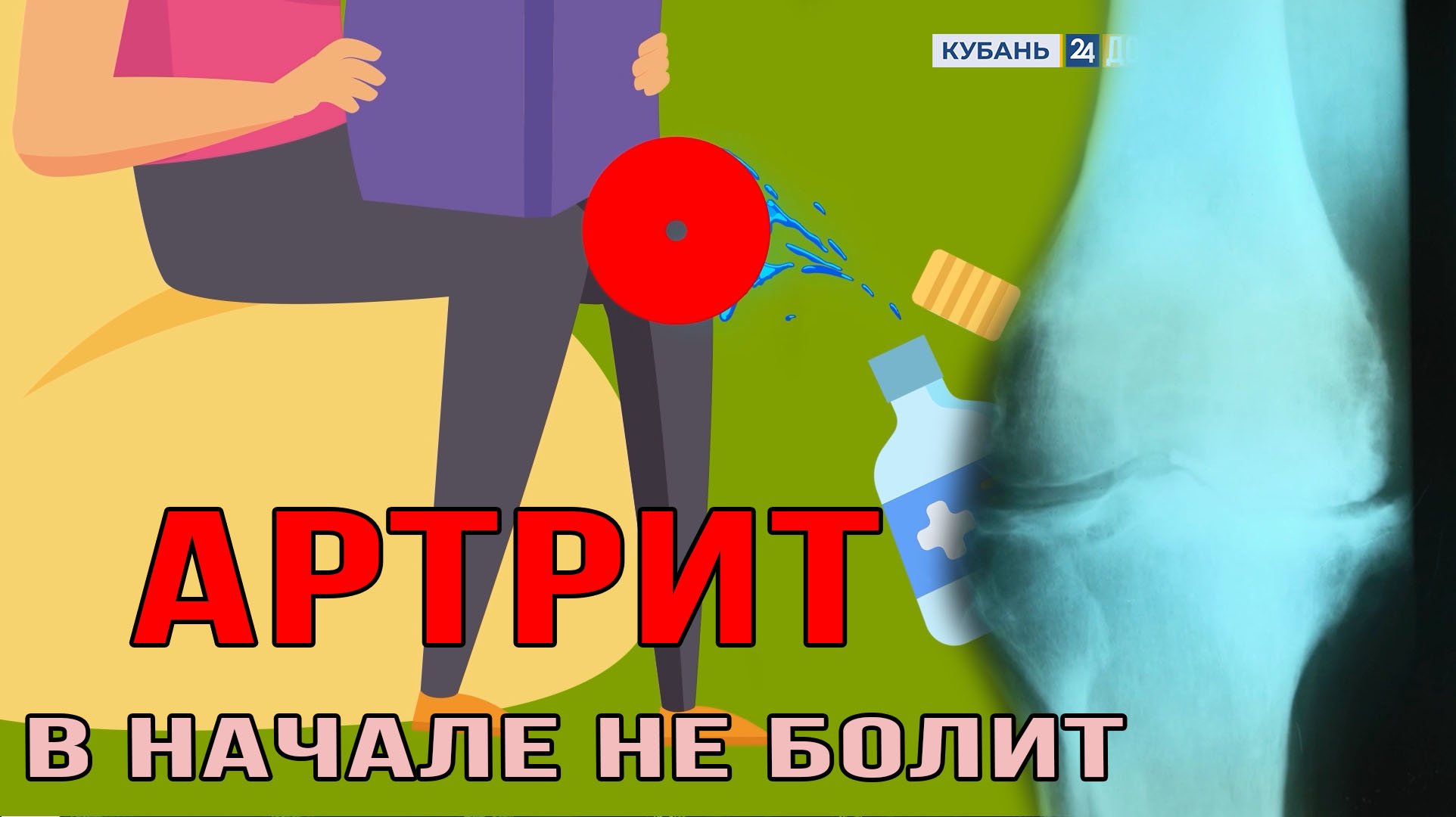 Воспалённые суставы ведут к обездвиживанию. "Медсовет"