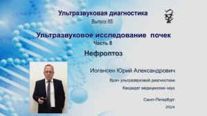 Ультразвуковая диагностика (УЗИ). Доктор Иогансен. Выпуск 85. Нефроптоз.