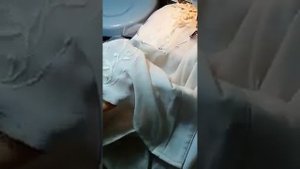 Ремонт прожженной дыры на одежде