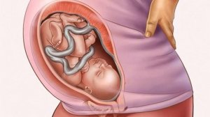 Беременность по неделям. 35 неделя беременности