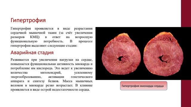 41. ВНУТРИКЛЕТОЧНАЯ РЕГЕНЕРАЦИЯ КАРДИОМИОЦИТОВ