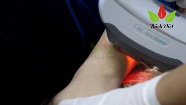 Máy triệt lông SHR - Triệt lông vĩnh viễn AFT - Máy thẩm mỹ BÁCH VIỆT смотреть онлайн