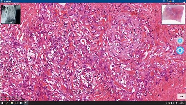 KFBIO 5 slides scanner смотреть онлайн
