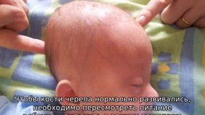 Большой родничок у ребенка — причины и последствия