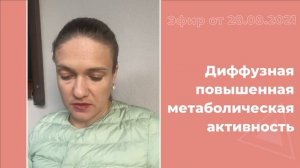 Диффузная повышенная метаболическая активность