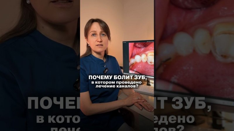Представьте: вам провели лечение каналов, но боль вернулась…  #dentistry#стоматология