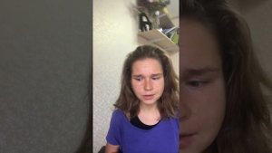 Жильбера синдром