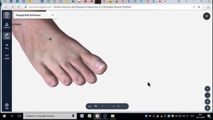 Результаты хиджамы на ноги  Ноги мерзнут