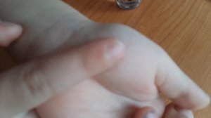 Как избавиться от шипиги