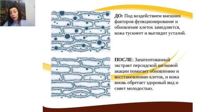 NovAge True Perfection 25+ Юлия Осипова смотреть онлайн