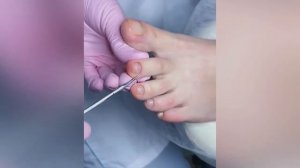 Чистый педикюр с ремувером??