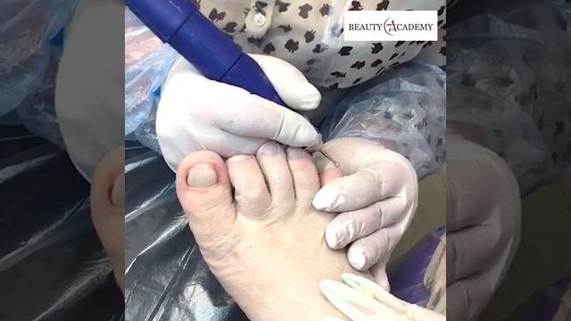 Обучение медицинскому педикюру