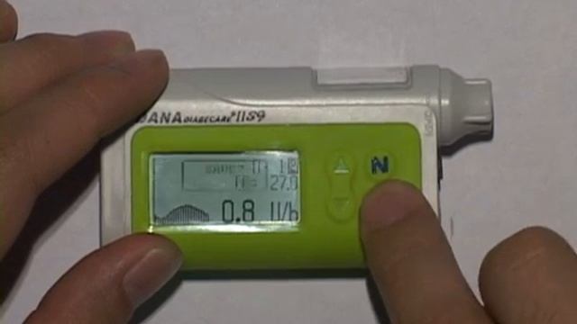 Управление инсулиновой помпой Dana Diabecare IISG смотреть онлайн