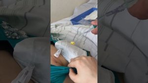 Порт для химиотерапии,