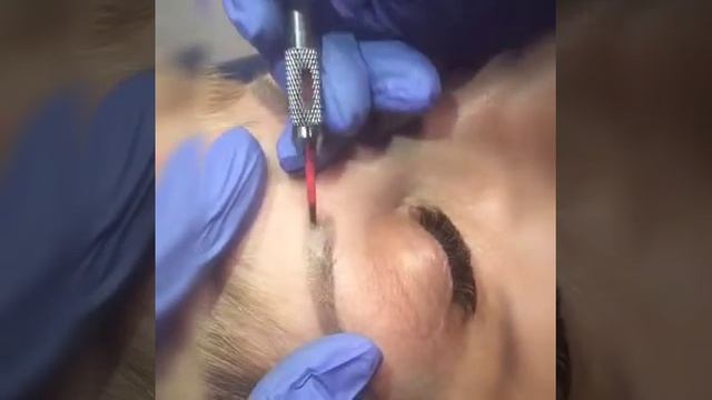 Удаление татуажа ремувером Ксения Данилюк Макеевка смотреть онлайн