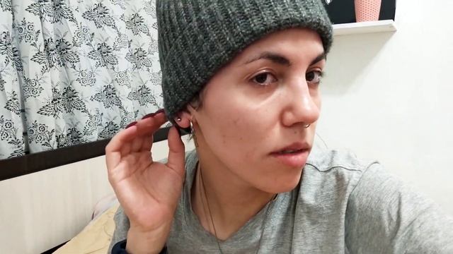 Андрогенная аллпеция | результаты от сатуры роста | купила мезороллер | 2 месяца без миноксидила