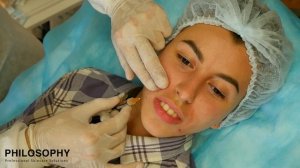 Коррекция периоральной зоны