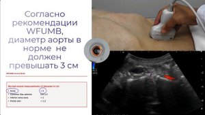 Ультразвуковое исследование  аорты, артерий подвздошных нижних  конечностей