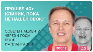Базальная имплантация зубов – отзыв реального пациента через 4 года