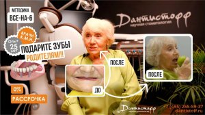 Подарите зубы РОДИТЕЛЯМ! Ирина 80 лет. Видеоотзыв Дантистофф.