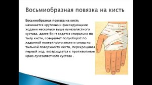 Восьмиобразная повязка