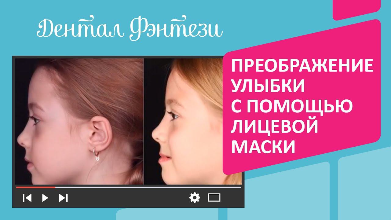 Преображение улыбки и строения лица ребёнка от врача-ортодонта Дентал Фэнтези Наргизы Хамраевой